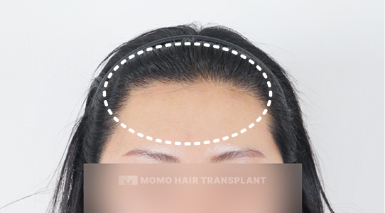 부자연스러운 디자인