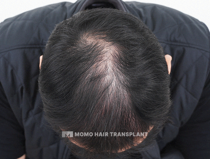 가르마 방향 고려