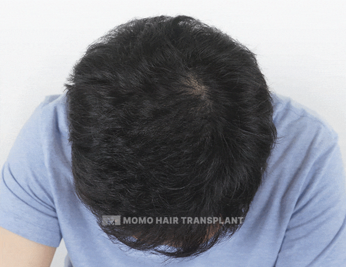 남성중심 디자인