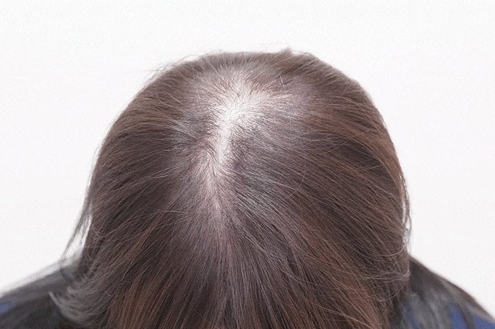 가르마 방향 고려s