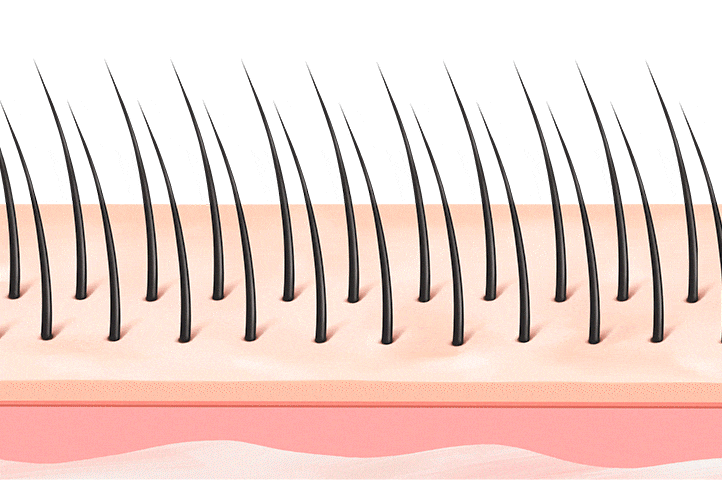 전체적으로 모발이 가늘어지는 유형