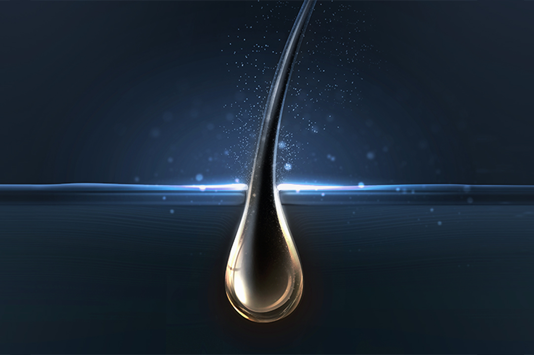 탈모도 이제 치료가 가능합니다!