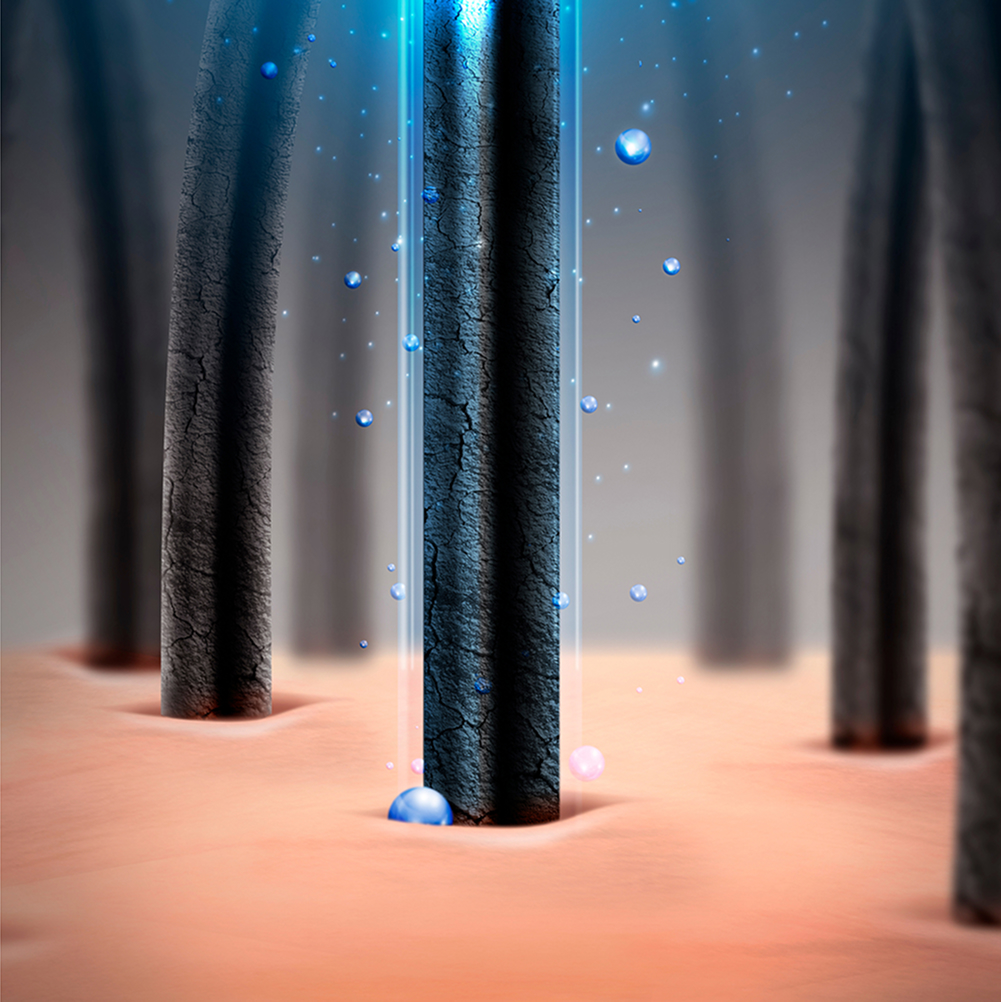 두피를 가장 잘 아는, 모발이식 전문의의 처방